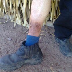 Camponês mostra ferimento